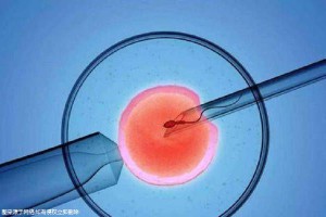 林教授